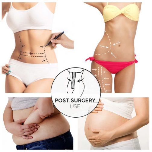 Stomach Slimming Tummy Control Shapewear - Image 3